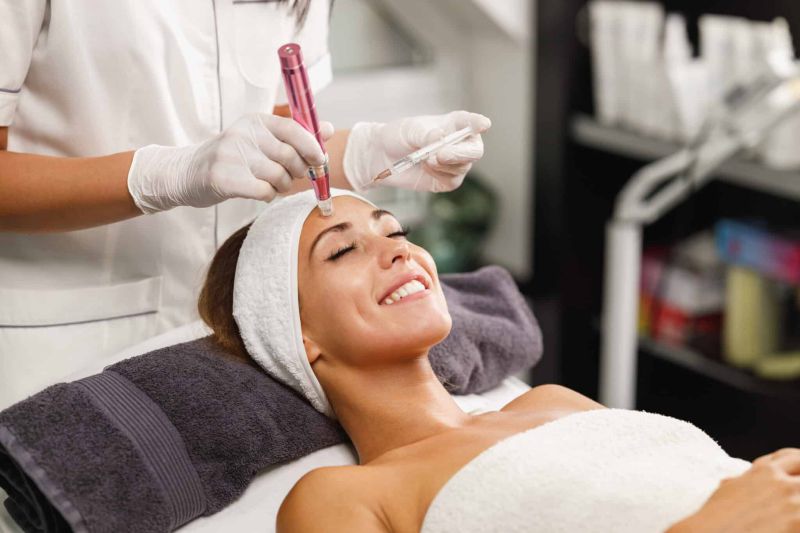 Microneedling Berlin
