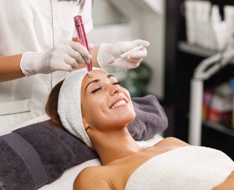 Microneedling Berlin